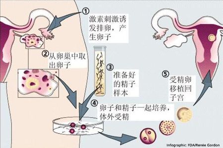 关于代生选性别包男孩